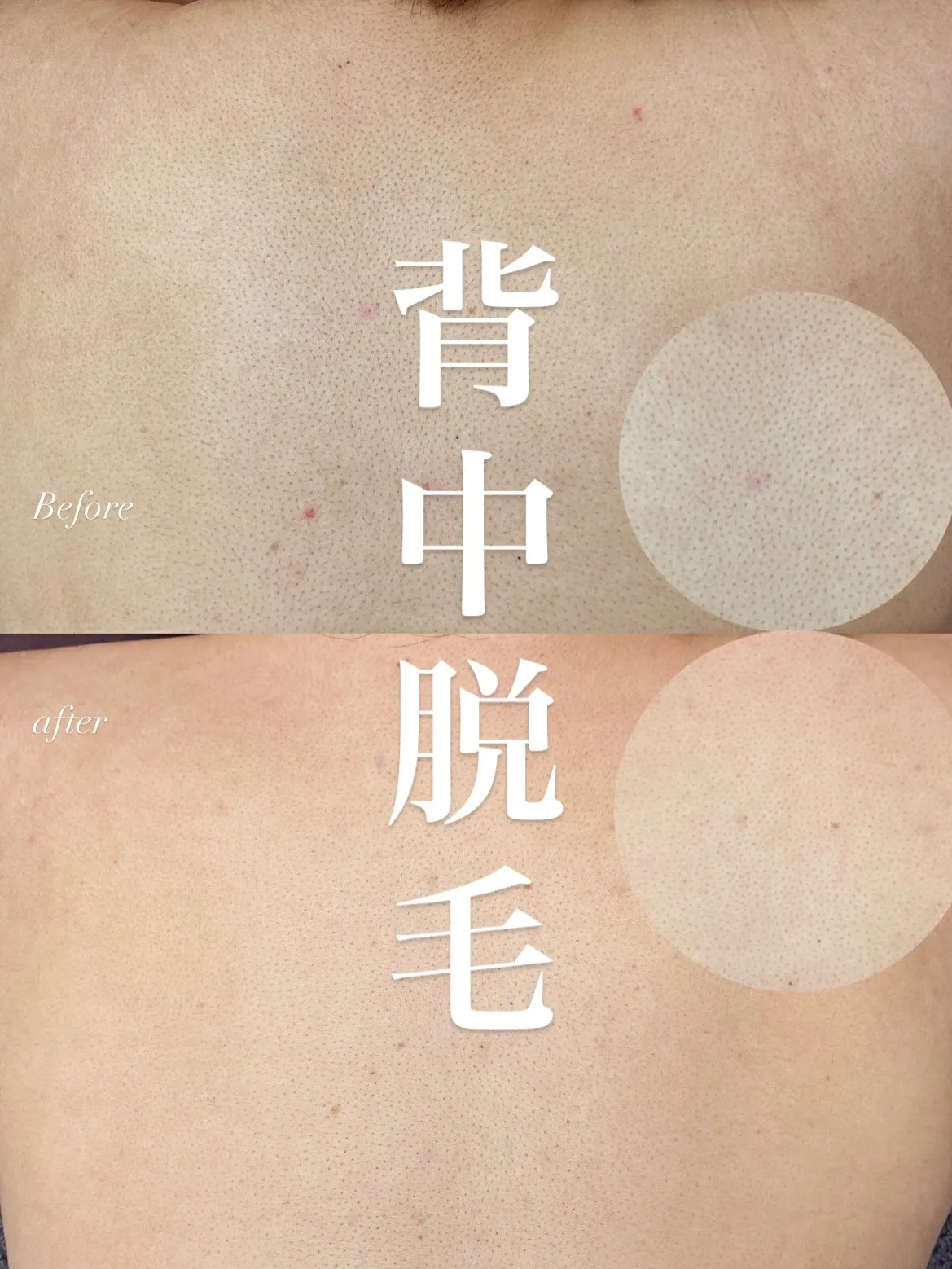 【明石・舞子からのアクセス◎都度払い脱毛★】